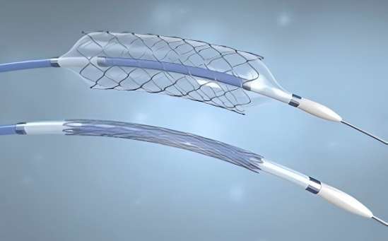What is a Balloon Angioplasty Catheter?