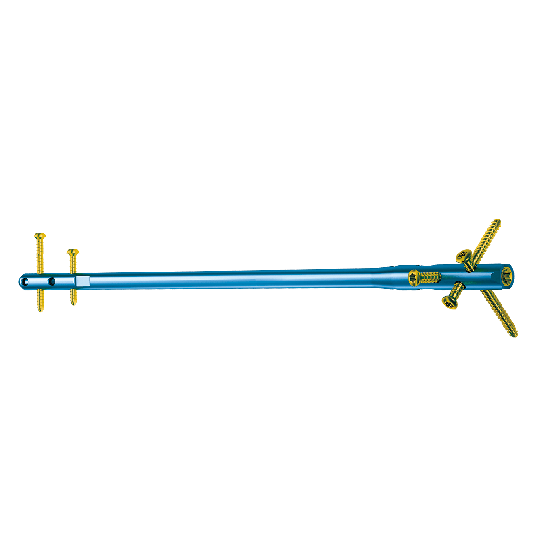 Sistema per unghie intramidollari ad incastro