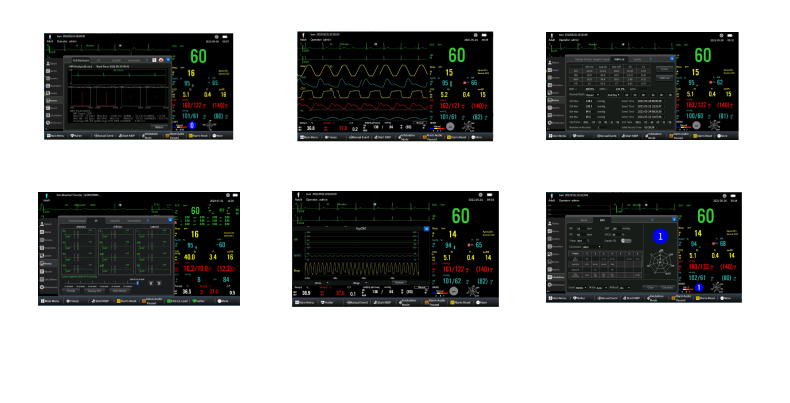 changes the working mode of the medical staffs and brings them unprecedented use experience. Powerfu...