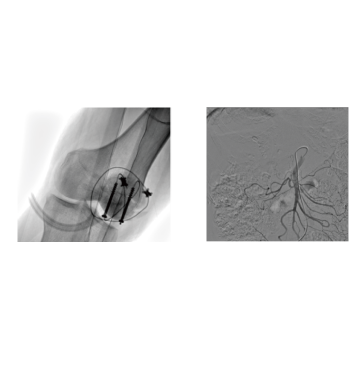 3. Comprehensive Coverage of Surgical and Interventional